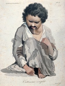 Totale cretinisme, uit een boek van Baron Jean Louis Alibert (1768-1837)